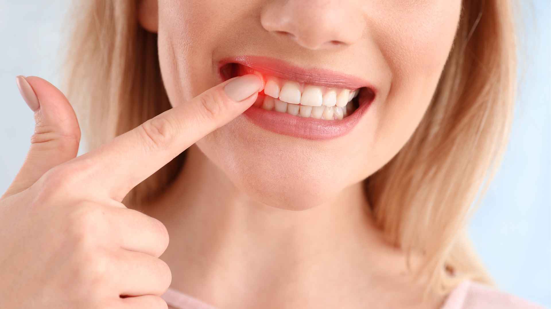 牙周病是什麼？自我檢查5徵兆