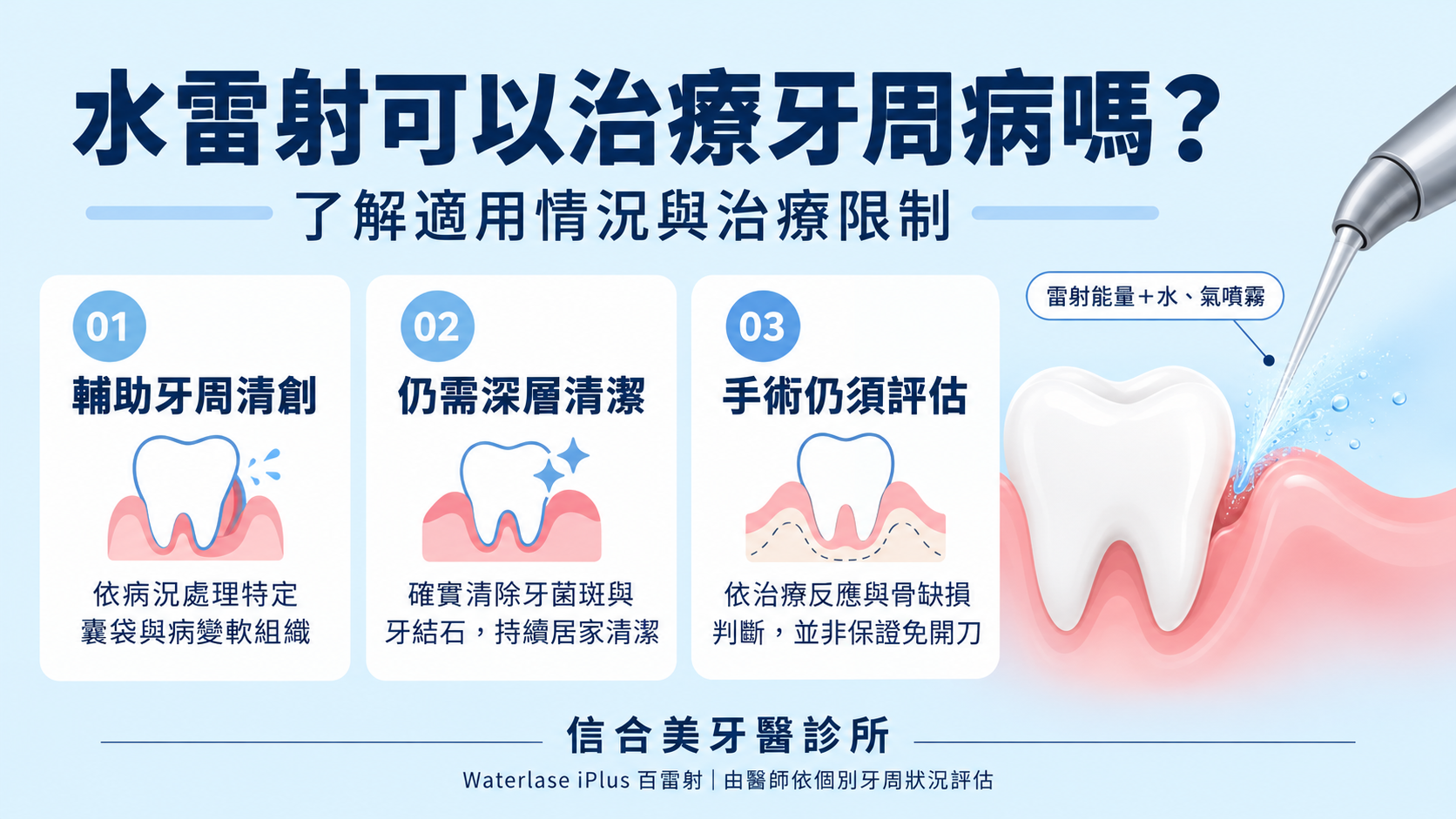 水雷射可以治療牙周病嗎？了解適用情況與限制